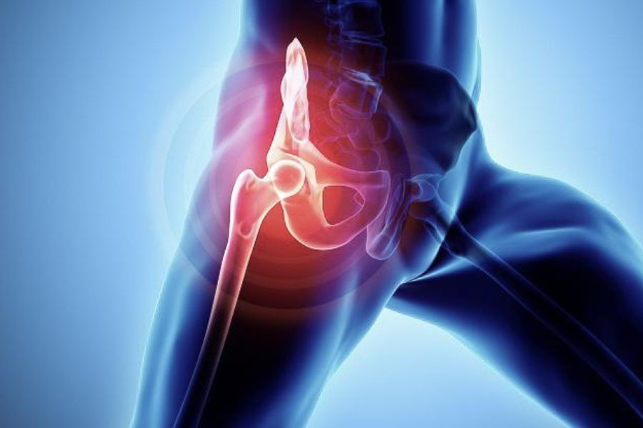 Chiropractic Care For Hip Pain From Coastline Chiropractic and Rehabilitation Center