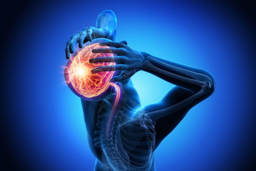 Chiropractic Care For Migraines From Coastline Chiropractic and Rehabilitation Center