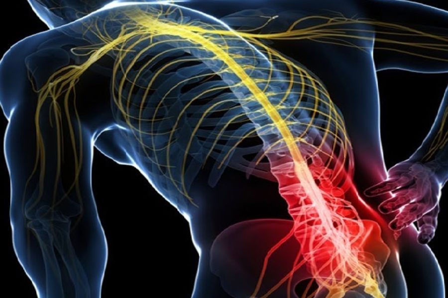 Chiropractic Care For Sciatica From Coastline Chiropractic and Rehabilitation Center