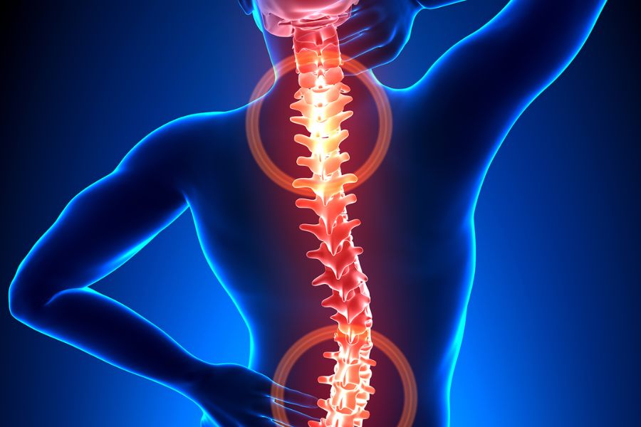 Chiropractic Care For Upper Back Pain From Coastline Chiropractic and Rehabilitation Center