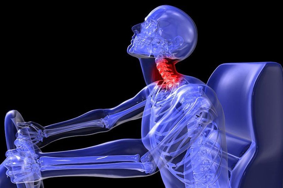 Chiropractic Care For Whiplash From Coastline Chiropractic and Rehabilitation Center